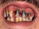 brit teeth.jpg